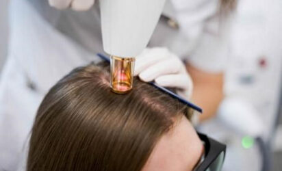 علاج الليزر للشعر - انبات الشعر بالليزر - كوارتز هير - اسطنبول