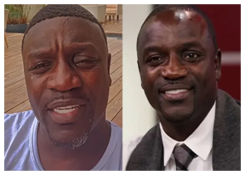 Akon-hair-transplant