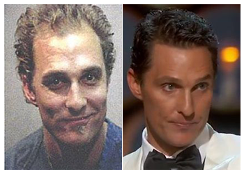 Matthew McConaughey hair transplant