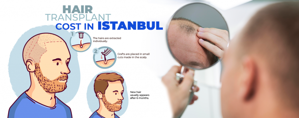 hair transplant cost in turkey