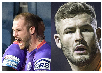 Zak Hardaker hair transplant