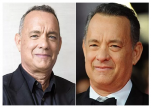 tom-hanks-hair-transplant
