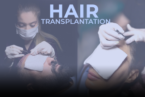 hair transplantation