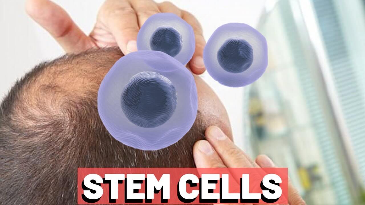 kok hucreli sac ekimi 1