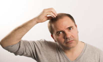 حكة الراس بعد زراعة الشعر - الاسباب والعلاج - كوراتز هير