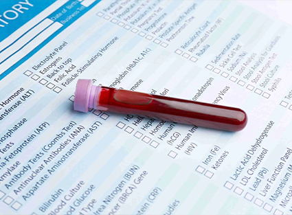 Before Hair Transplantation 7 blood tests