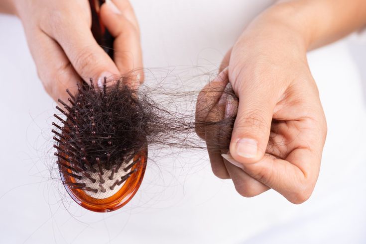 Hair Filler 6 hair loss treatments