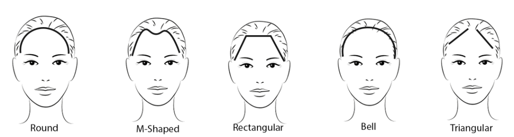 women hairline types