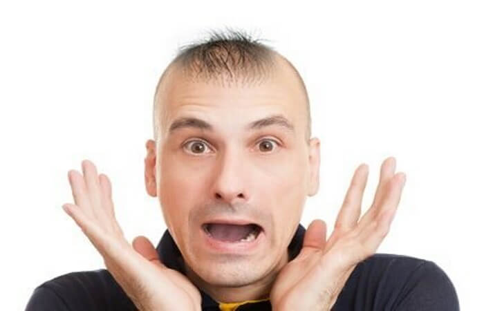 فشل زراعة الشعر 3 اسباب فشل زراعة الشعر