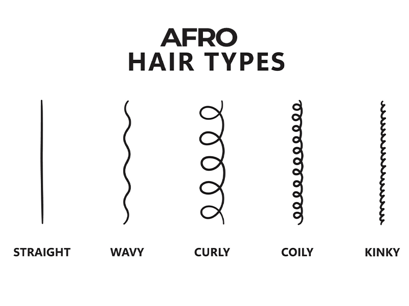 Afro Hair Transplant 5