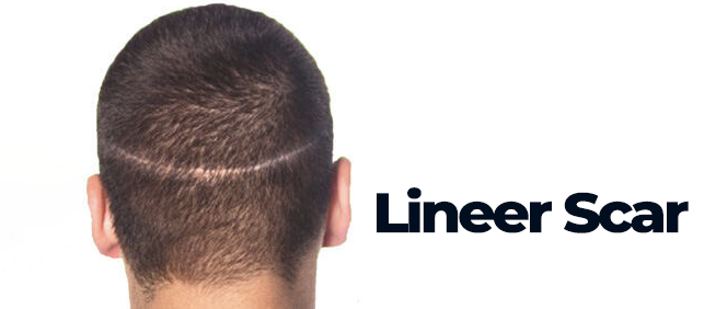 lineer scar fut