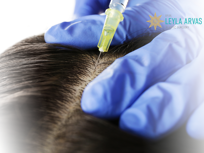 FAT Hair Transplant 3 FAT Hair Transplant
