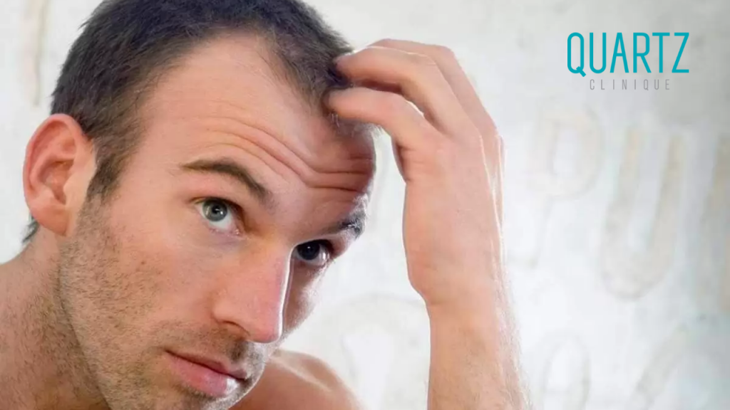 Causes of Hair Transplant Failure 3 Causes of Hair Transplant Failure