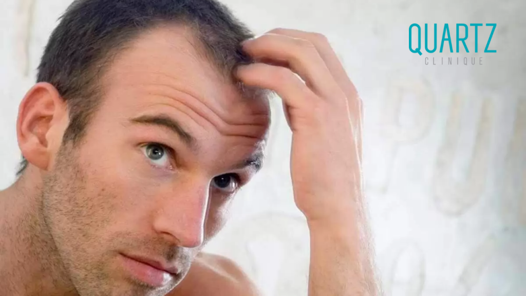 Causes of Hair Transplant Failure