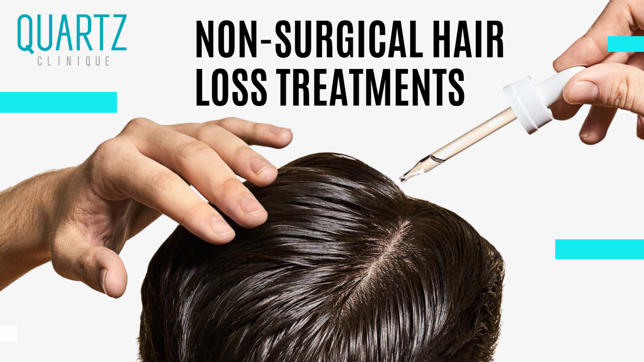 Non-Surgical Hair Loss Treatments