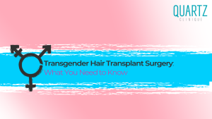 Transgender Hair Transplant Surgery