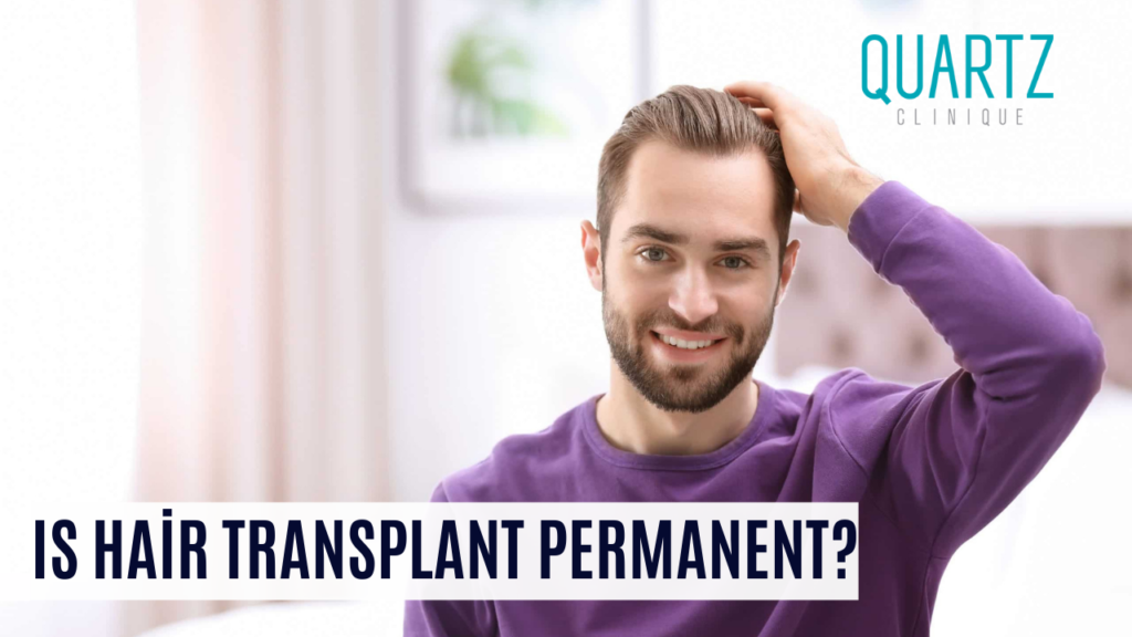 Is Hair Transplant Permanent