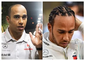 Lewis-Hamilton-Hair-Transplant
