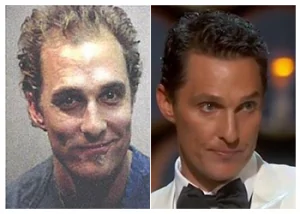Matthew-McConaughey-hair-transplant