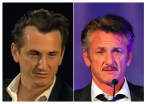 Sean-Penn-Hair-Transplant