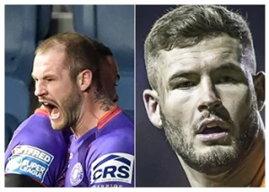 Zak-Hardaker-hair-transplant