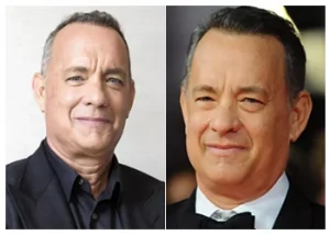 tom-hanks-hair-transplant