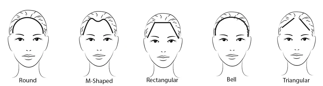 Hair Restoration 2 women hairline types